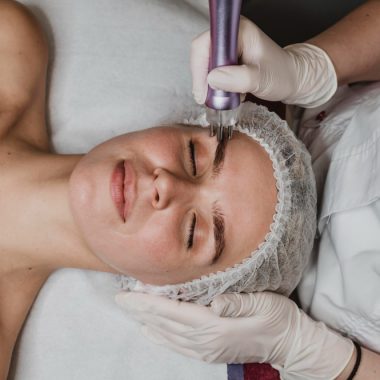 Advanced skin renewal through plasmaporation and fractional technology